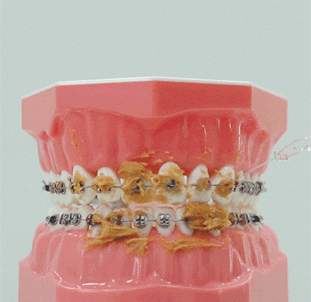 BAS 휴대용 구강세정기 3가지 세정모드(물치실,치아 치간 세정기)